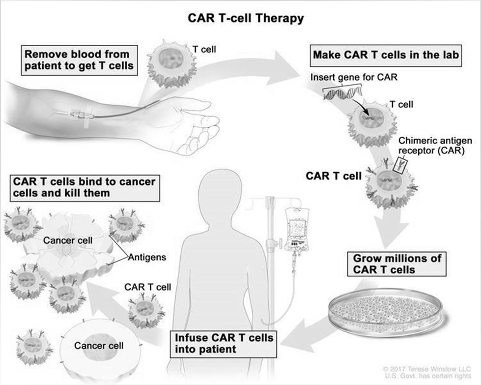 Genterapi med T cellereseptorer kan kjenne igjen mål inne i kreftcellene pasientens mutasjoner kartlegges og settes inn på ett gen som introduseres for immunceller fra friske donorer.