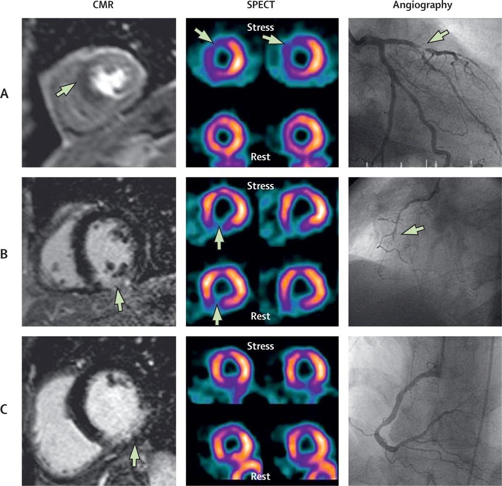 Figure 3 Source: The Lancet 2012; 379:453-460