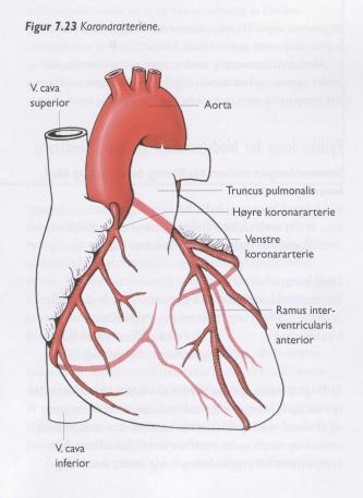 Husker du? Hjertets blodforsyning Forsynes med blod av koronararteriene som går av på begynnelsen av aorta (høyre og venstre koronararterie) Hjertemuskelen har liten evne til anaerob metabolisme.