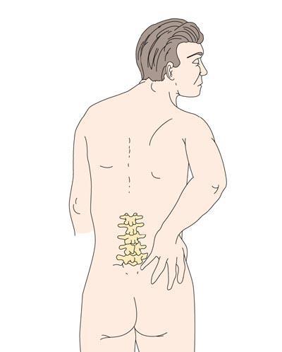 Spondyloartritt -hva forteller pasienten?