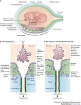 From: Parham PJ Unormal, 2004 blodstrøm til placenta Gir lavtrykks blodstrøm til placenta Normal placentering: arterie-remodellering dypt inn i myometriet: fjerner glatt muskulatur 9 rundt karene