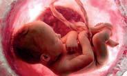 Dødt foster De fleste kan forløses vaginalt 90% føder i løpet av 24 timer.