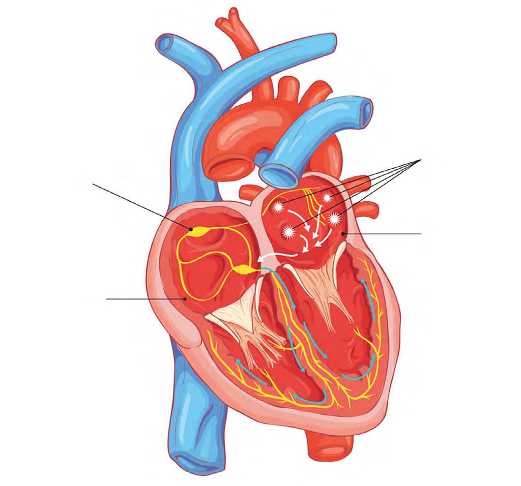 Hva er atrieflimmer? Atrieflimmer er en hjerterytmeforstyrrelse i hjertets elektriske system og er den vanligste formen for hjerterytmeforstyrrelse i Norge.