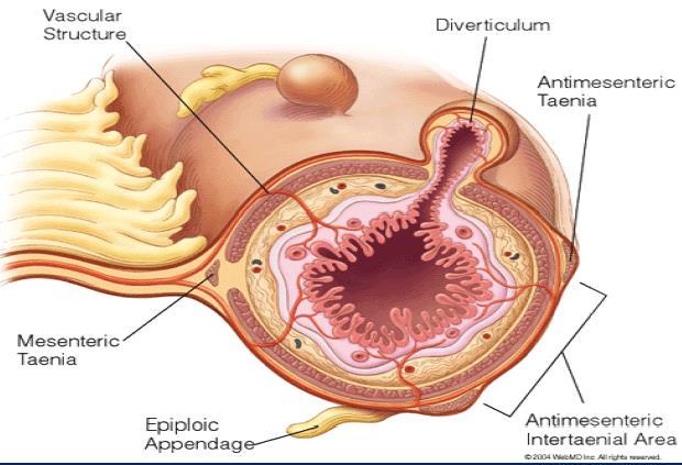 Diverticulosis coli Prevalens