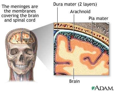 Hjernehinnebetennelse Hjernehinnebetennelse, eller meningitt, er en viruseller bakterieinfeksjon i hjernehinnene.
