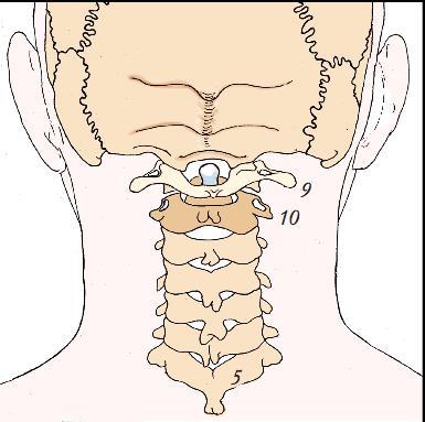 Columna vertebralis ryggraden A t l a s C 1 A x i s C 2 C 7 V e r t e b r a p r o m i n e n s T h 6 T h 1 2 L 5 S a c r u m C o c c y g i s 29 C o l u m n a d o r s a l v y C o l u m n a a n t e r i