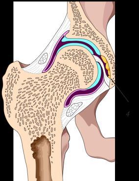 capites femoris Anteriort Medicinskt