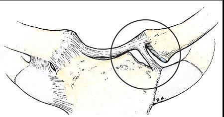 Art. Sternoclavicularis