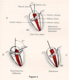 Øyemuskler Øyemuskler Vertikale rectus muskler (superior og inferior) løper i samme vinkel som den orbitale akse - 23º på den optiske akse Når øyeeplet er abdusert til 23º vil superior rectus kun