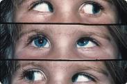 Øynene roteres i samme retning Yoked muscles eks HLR og VMR Muskelpar Ipsilaterale antagonister (Sherringtons lov) HMR/HLR HSO/HIO HSR/HIR Kontralaterale synergister (Yoke Herings lov) HMR VLR HLR