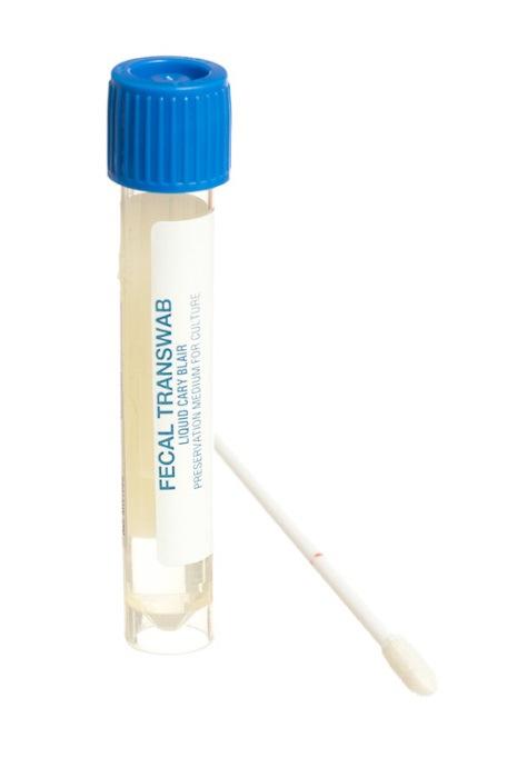 Fecesdiagnostikkenved HUS Oversikt Gjennomgang av vårt fullautomatiserte system (FLOW) for analysering av fecesprøver på PCR Fordelar og utfordringar ved bruk av FLOW Oppstart av feces-pcr april