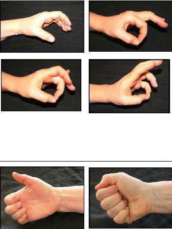 Redusert håndfunksjon har betydning for evnen til å utføre daglige aktiviteter Både bevegelighets- og styrketrening