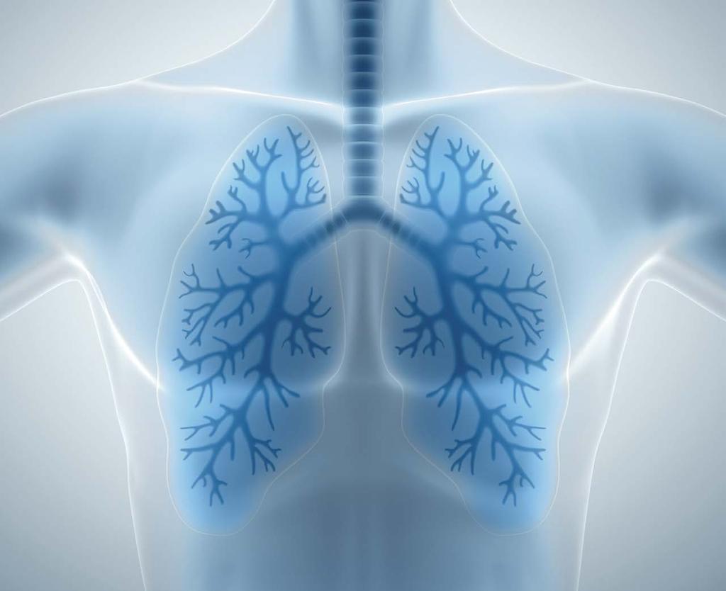 Lungekreft er et viktig satsingsområde for Roche, og vi er opptatt av å utvikle nye behandlingsmetoder, medisiner og tester som kan hjelpe pasienter.