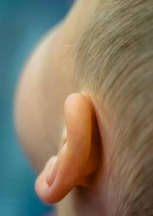 Når ørene virker, men hjernen ikke forstår Barn med auditive prosesserings vansker (APD) Mellom 3 til 5 % av barn lider av vansken APD