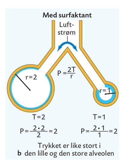 Mer surfaktant i små alveoler Overflatespenning mest redusert i små alveoler Åpen
