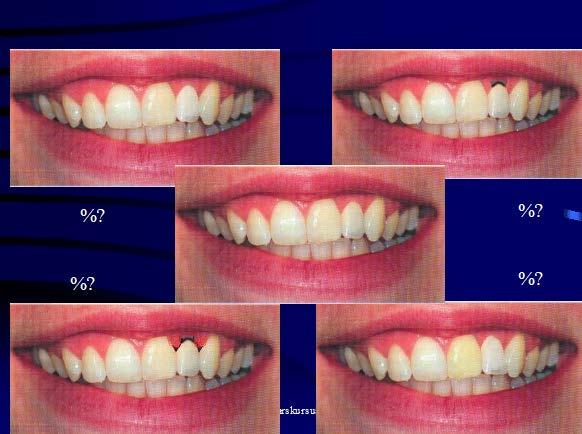 Dentists #1 #2 Location Mandible Maxilla Bivariate Bivariate 95% significance odds ratios Confidence intervals bivariate odds ratios - 2.