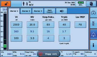 Hovedinnstillinger Manuell respirasjon Overfør data Import / eksport Vis Dato / Tid Enheter / Valg Tilbakestill Tidevolum (Vt) Minuttventilasjon (MV) Respirasjonsfrekvens Trykk Lav PEEP