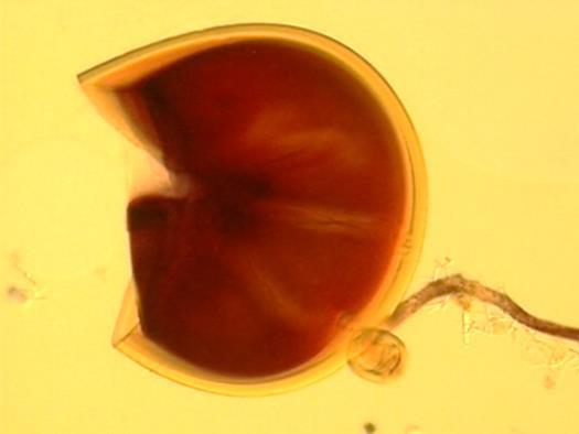 Scutellospora calospora, som er mer vanlig i jordbruksjord