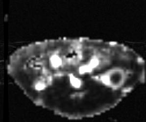DCE-MRI in practice Blood flow in normal rabbit kidney