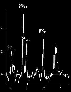 lipid og laktat lipid I