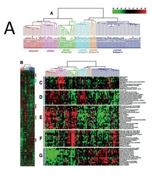 Figur 5. Tema A. Unsupervised genekspresjonsanalyse med hierarkisk clustering definerer subtyper i brystkreft basert på utrykk av 456 gener.