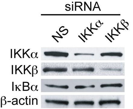 2 Representative immunofluorescence images of Jurkat cells overexpressing constructive active (SSEE) or kinase-dead (SSAA) IKK construct.
