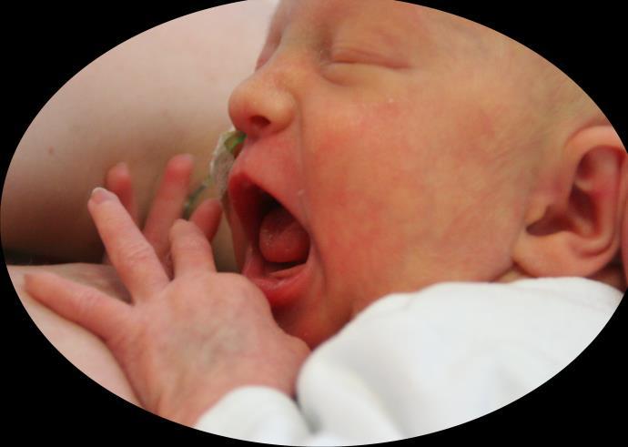 MORSMELK Nyfødt intensiv er godkjent som en mor-barn-vennlig avdeling. Det betyr blant annet at morsmelk og amming har høy prioritet.