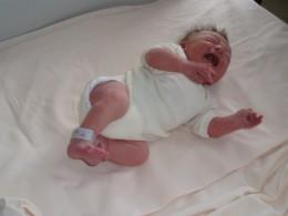 Neonatalt abstinenssyndrom (NAS) NAS opptrer hos 30-90% av nyfødte som har vært eksponert for metadon/buprenorfin (Osborn 2010, Mactier 2013) Oppstår etter fødsel som følge av plutselig stopp i