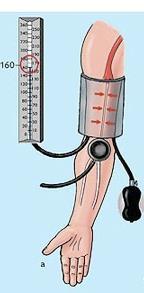 Blodtrykk Blodtrykket (BT) = Minuttvolum (MV) x Total perifer motstand (TPM) TPM er den Totale Perifere Motstand = motstanden i hele det systemiske kretsløpet WHO: høyt blodtrykk > 160/95 mmhg 140/90