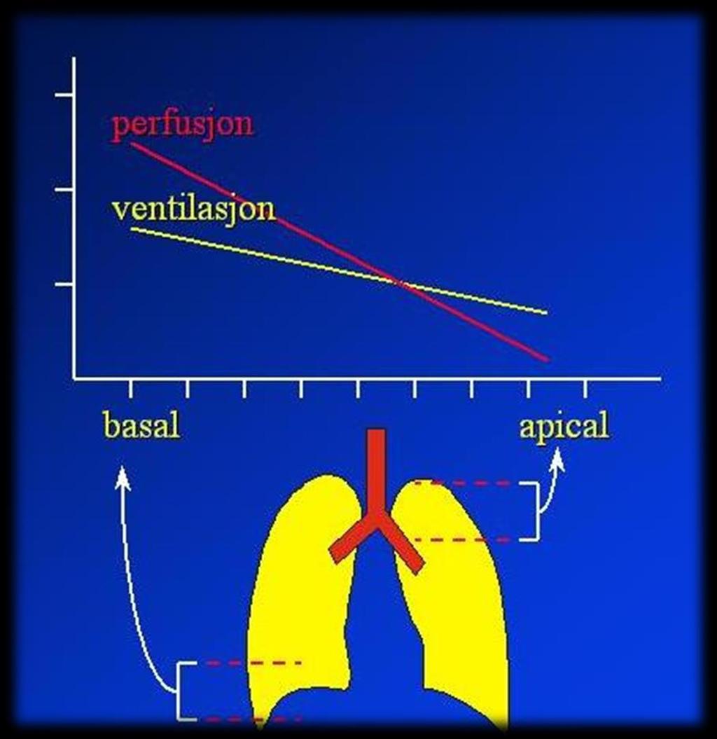 Ventilasjon og sirkulasjon i ulike deler av lungen En våken og oppreist person har best ventilasjon i nedre del av lungen Der er også sirkulasjonen best Sirkulasjon i lungen: Blod renner nedover.