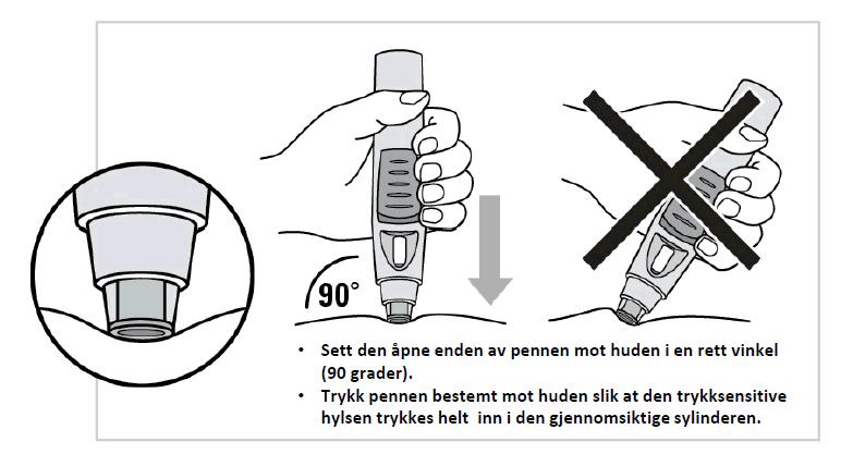 Du kan velge mellom to injeksjonsmetoder. Injeksjon uten å klype sammen huden er anbefalt (figur 5a).