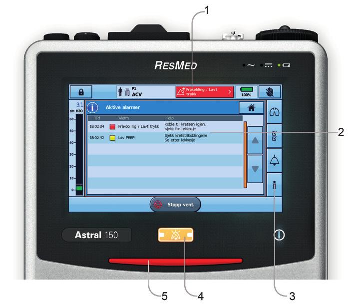 Alarmer Alarmer Astral-apparatet aktiverer alarmer for å varsle deg om tilstander som krever oppmerksomhet for å sikre pasientens sikkerhet.