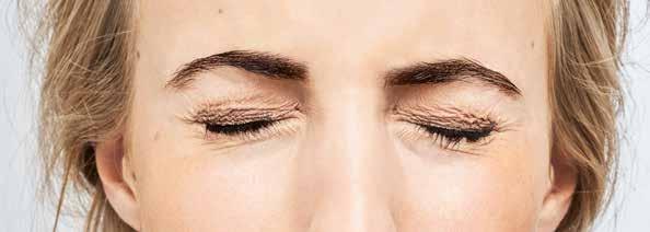 Daglig øyelokkbehandling i tre steg for personer med MGD 1) VARME For å myke opp fettet og fjerne blokkeringene i de meibomske kjertlene kreves det varme.