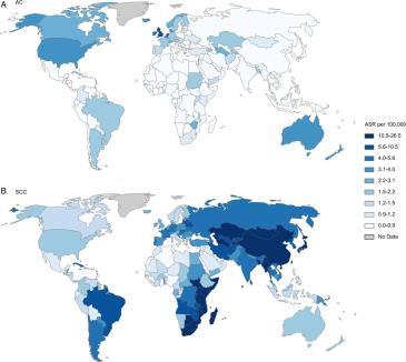 Age-standardised incidence rate (ASR) per 100 000 of (A) oesophageal adenocarcinoma and (B) squamous cell carcinoma in men Adenokarsinom Insidensrate for spiserørskreft fordelt på plateepitel- og