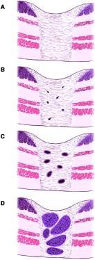 til regresjon) 3 Modifisert fra Chirieac et al., 2005 og CAP, 2013 Mikro 1. Hva resektatet omfatter, evt. neoadjuvant behandlet 2. Tumors lokalisasjon og størrelse 3.