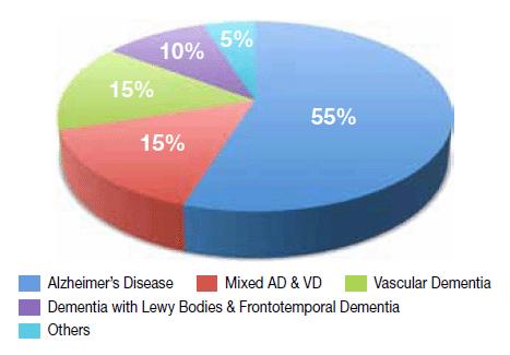 Ulike demenstyper Demens Alzheimer Vaskulær demens