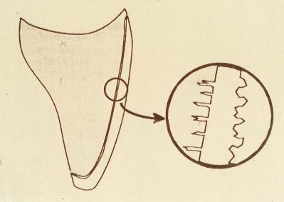 Indre flater må være klargjort mikromekanisk av tanntekniker & kjemisk av tannlege før sementering Fra tanntekniker: