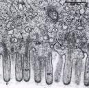 Mikrovilli Celletyper på villi og krypter Enterocytter Vanligst Høye søyleceller med mikrovilli (børstesøm )
