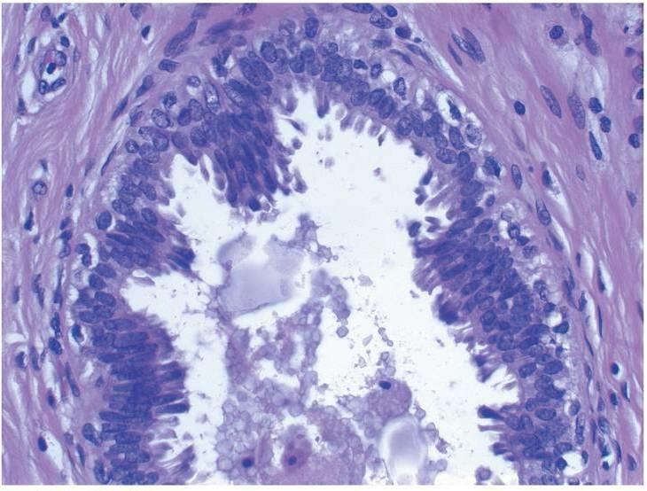 Columnar cell