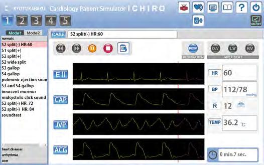 Palpasjon av hjerteimpulser RV, LV og DLV er simulert og kan palperes.
