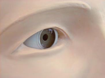 øyebakgrunnen med brukerens eget oftalmoskop.