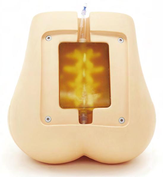 Ultralydkompatibel lumbalpunksjons/- epidural simulator M43E M43E Denne ultralydkompatibele punksjonsblokken er anatomisk riktig og