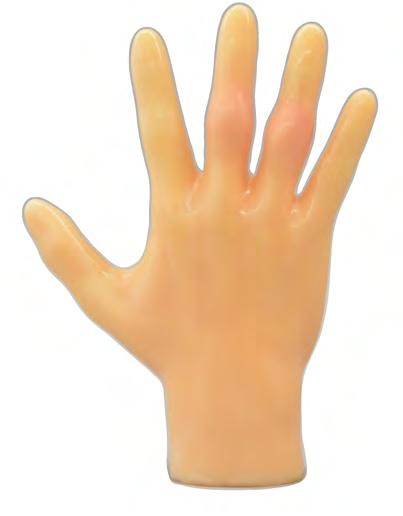 Revmatoid håndfantom US-17 Ultralydundersøkelse er en viktig ferdighet for