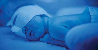 D-104477-2013 D-94092-2013 MT-3704-2007 EFFEKTIV Identifiserer nøyaktig de nyfødte i risikogruppen og eliminerer gjetting Analyserer nyfødte så unge som 24 uker gestasjonsalder Hjelper deg å etablere