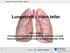 Lungekreft tiden teller