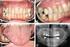 Tannlegen og pasienten: En oppfølgingsstudie av pasienter som har gjennomført behandling av tannbehandlingsangst