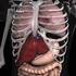 Anatomi II. Skjelettsystemet. Organsystemer. Organ Organsystem: Skjelettsystemet: Oppbygning Funksjon (ledd) Svein Ove Husnes